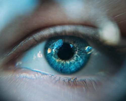 Degeneracion-macular